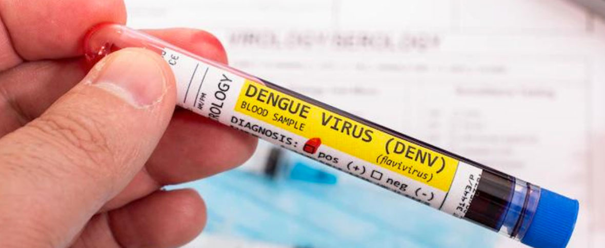 how-to-identify-dengue-fever
