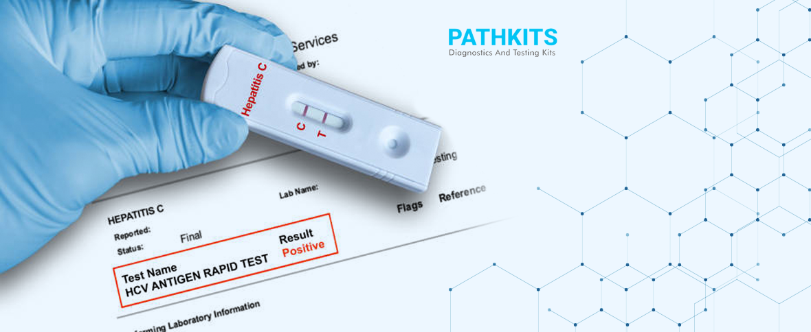 the-advantages-of-hcv-rapid-test-kits-for-hepatitis-c-virus-diagnosis